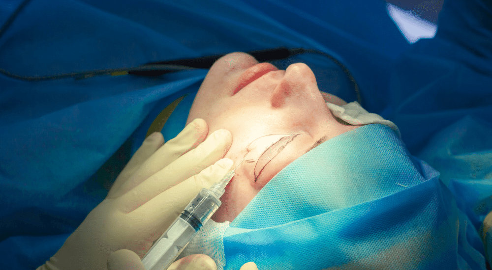 Blepharoplasty